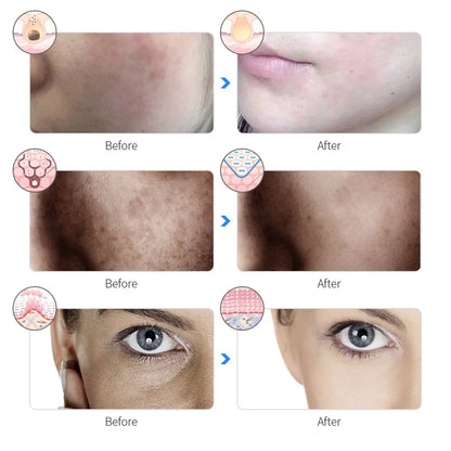 7-Color LED Beauty Mask