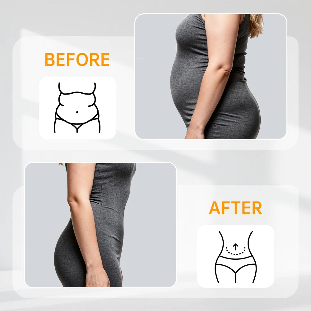 SculptFit Waist Trainer Corset