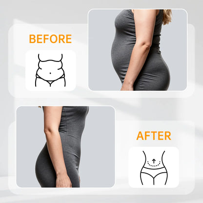 SculptFit Waist Trainer Corset